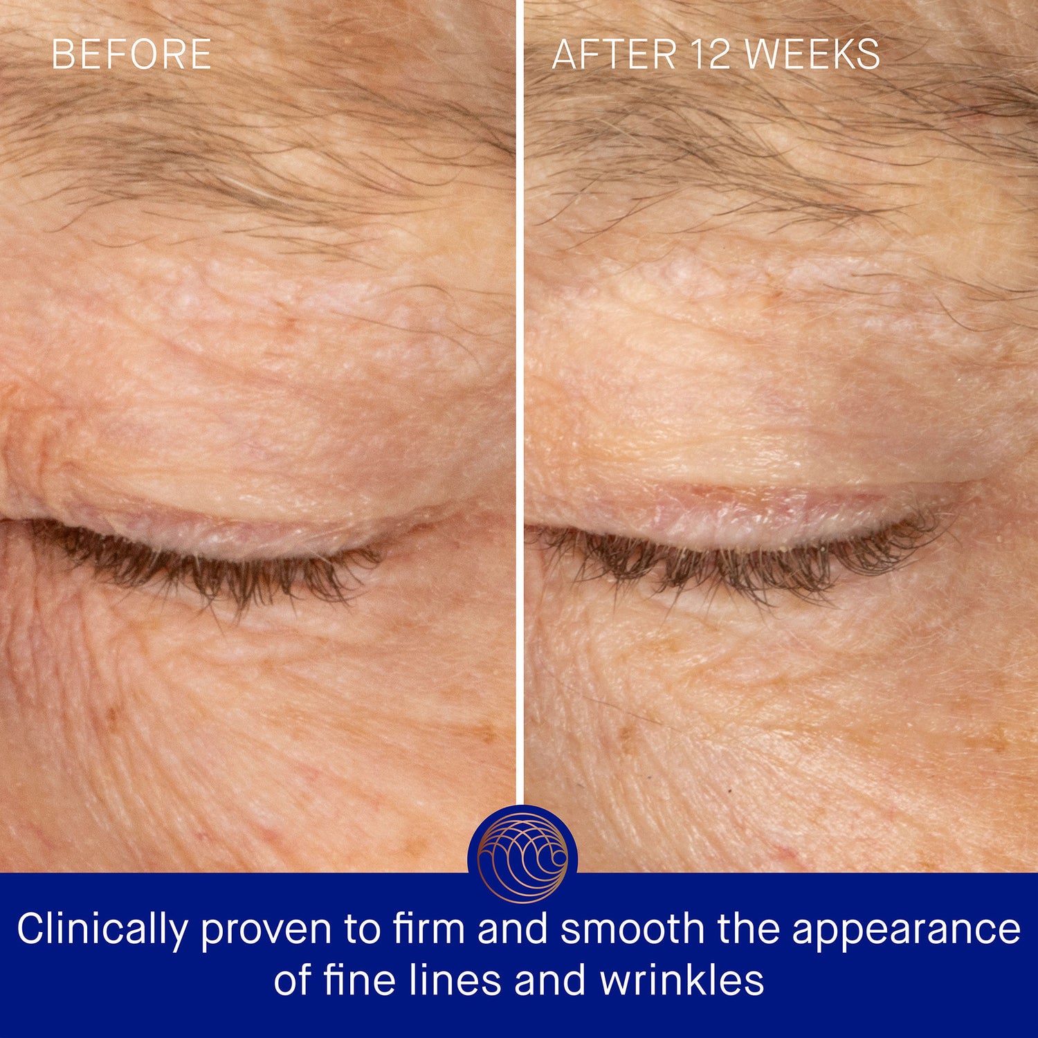 Before and after results of using Augustinus Bader The Rich Eye Cream