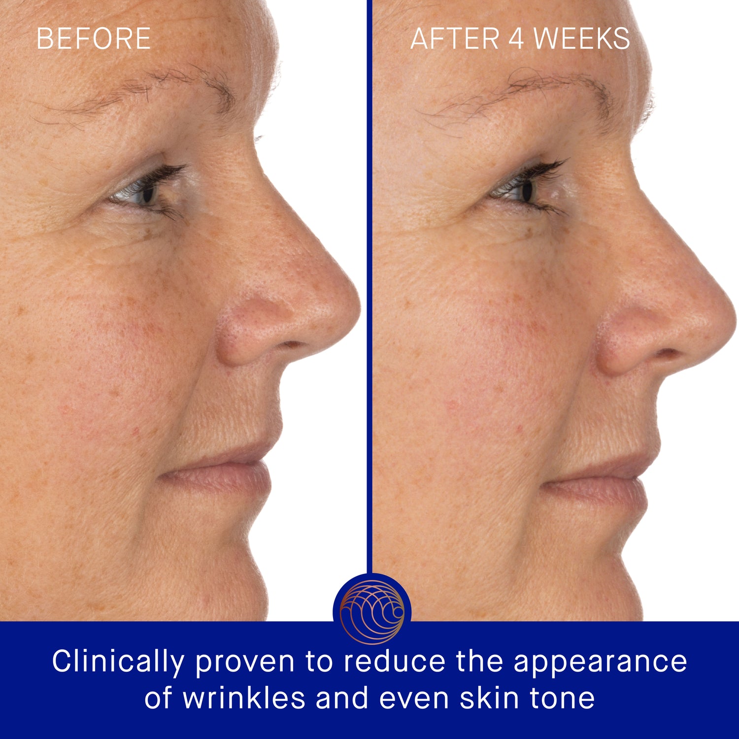 Before and after results of using Augustinus Bader The Mineral Sunscreen SPF 50