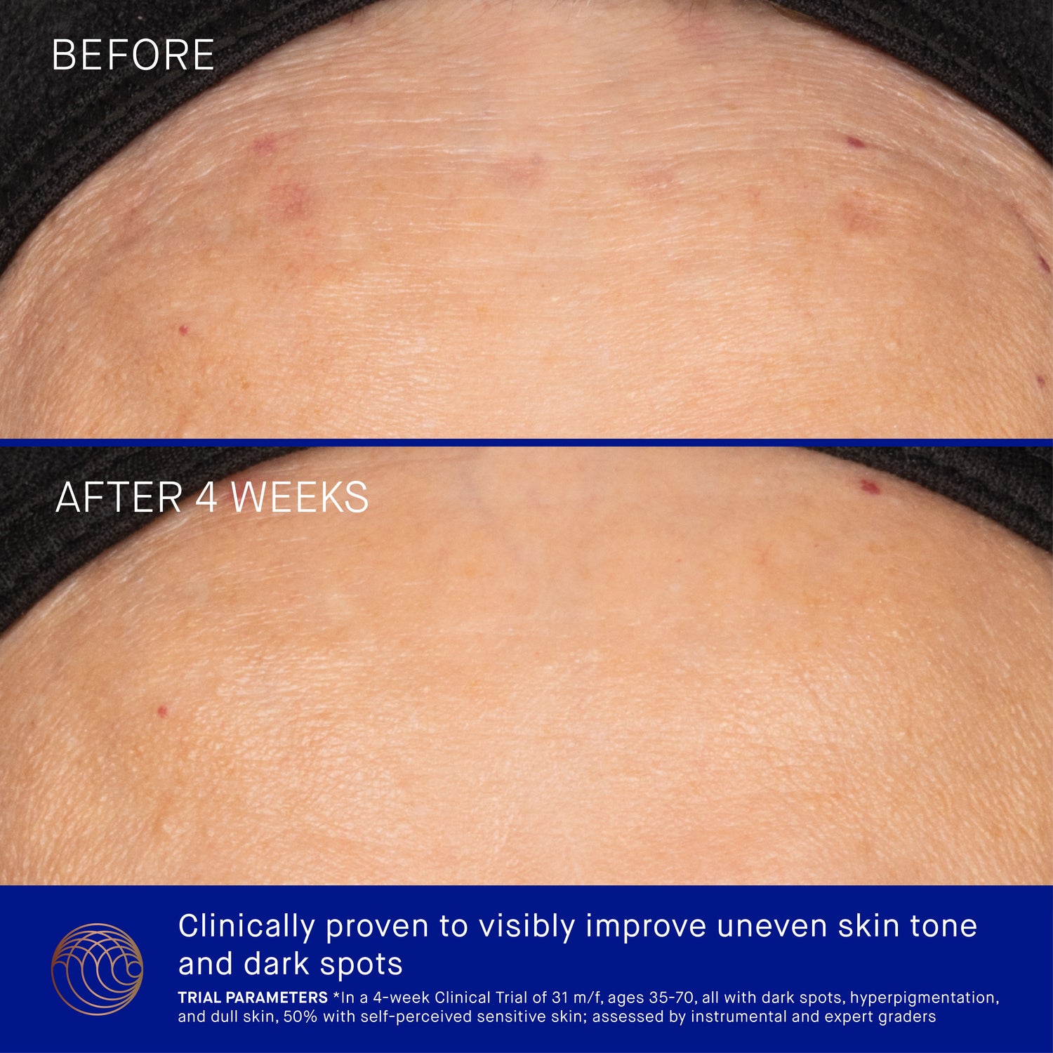 Before and after results of using Augustinus Bader The Vitamin C Serum