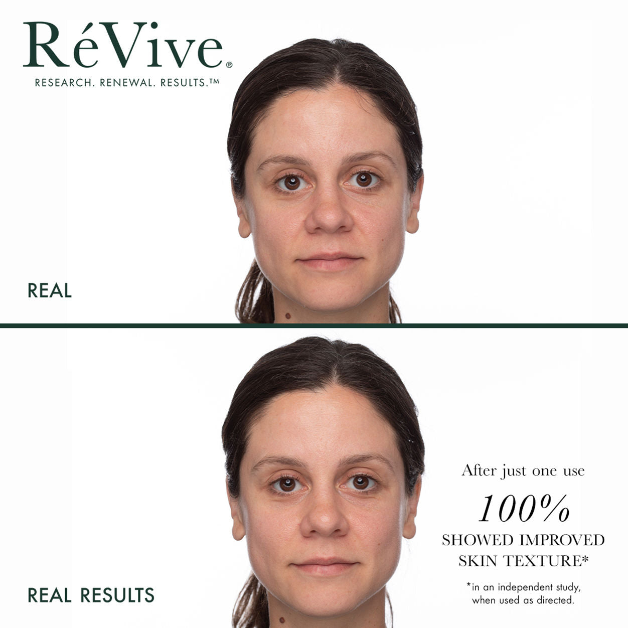 Before and after results of using RéVive Masque De Brilliance Resurfacing Multi-Acid Mask