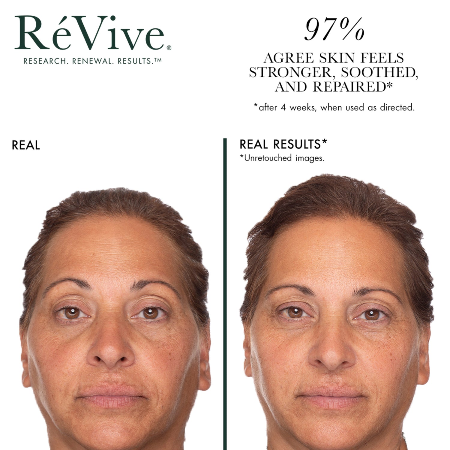 RéVive Sensitif Calming Serum Skin Barrier Repair before and after image .