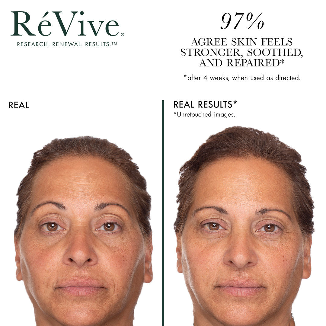 Before and after results of using RéVive Sensitif Calming Serum Skin Barrier Repair