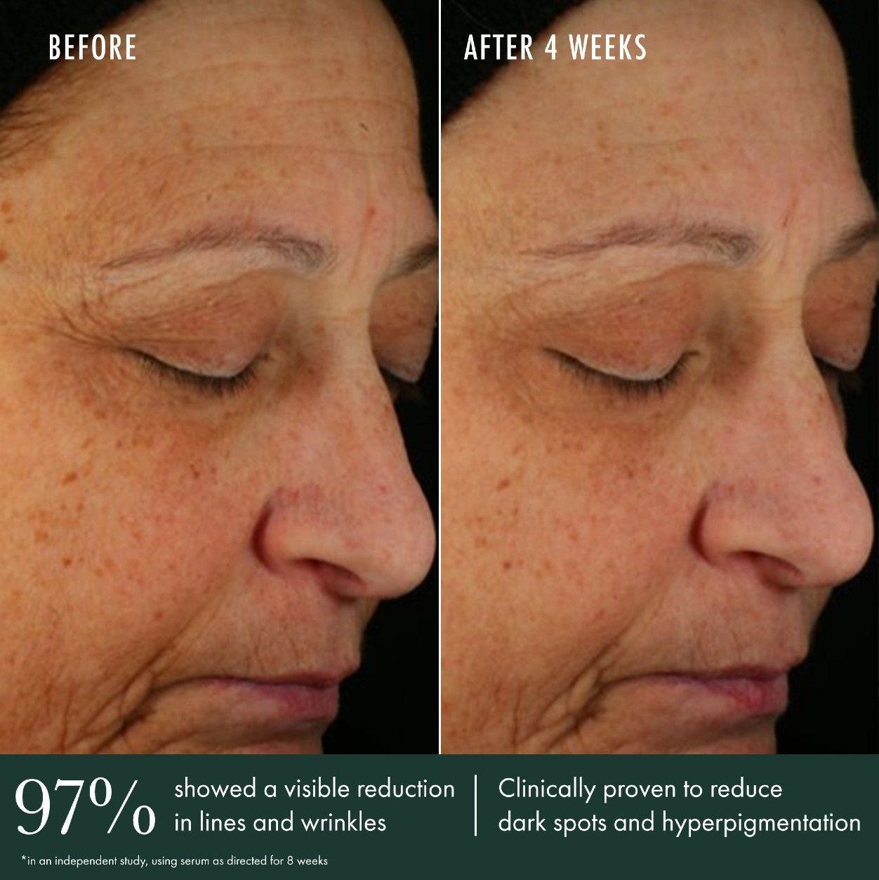 Before and after results of using RéVive Brightening Serum