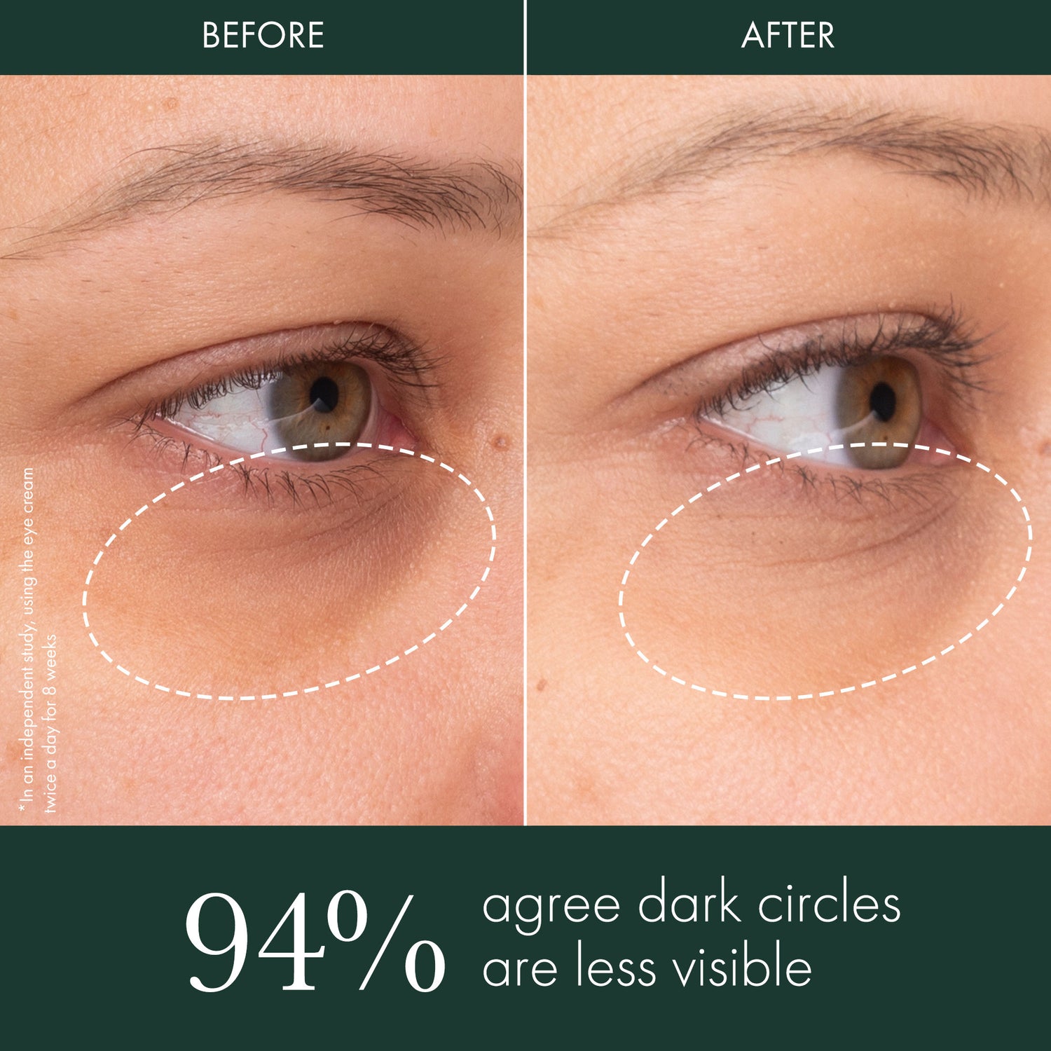 Before and after results of using RéVive Brightening Eye Cream Under Eye Illuminator