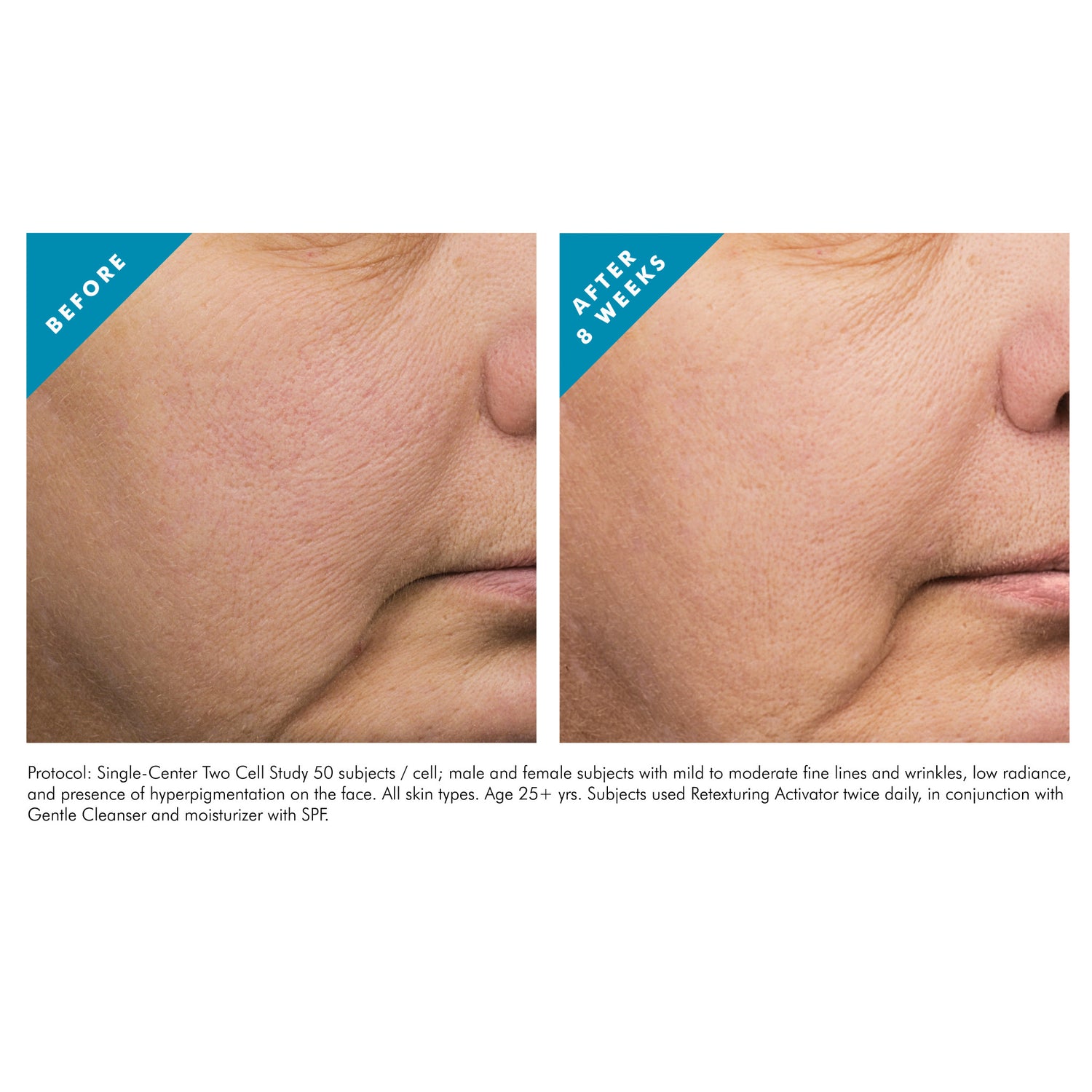 SkinCeuticals Retexturing Activator before and after image .