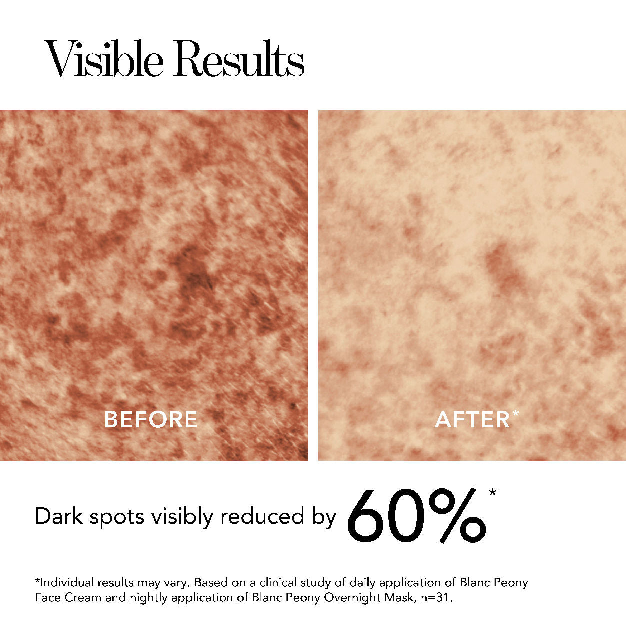 Image of an open Chantecaille Blanc Peony Brightening Overnight Mask for Dark Spots