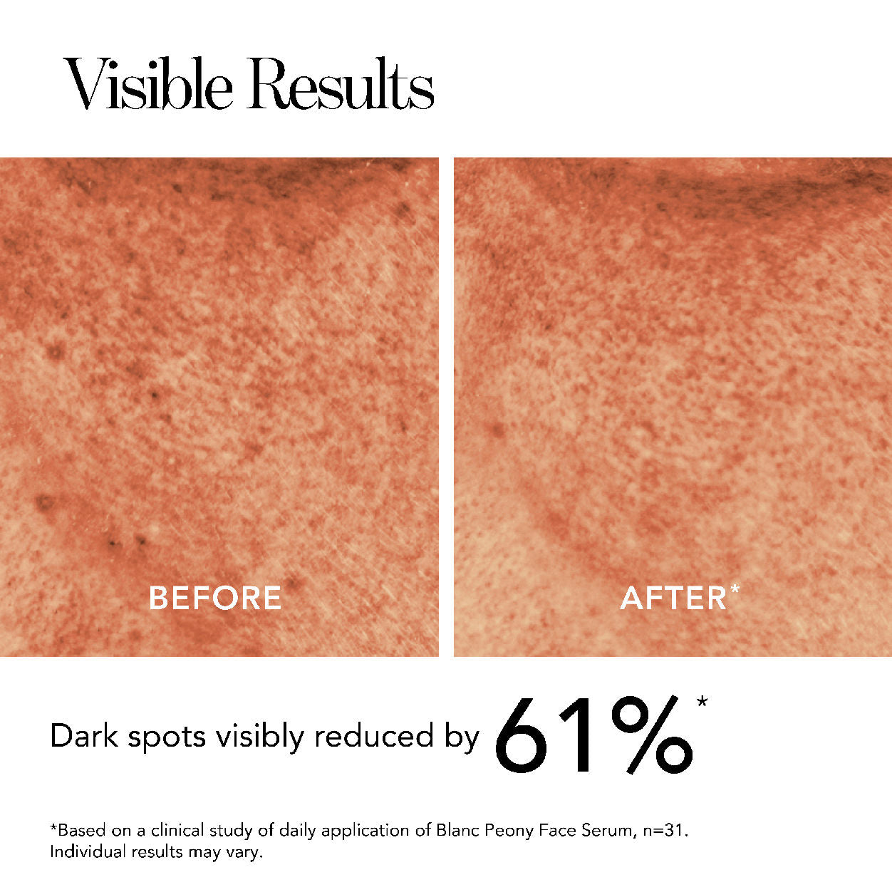 Packette image of Chantecaille Blanc Peony Face Serum for Dark Spots