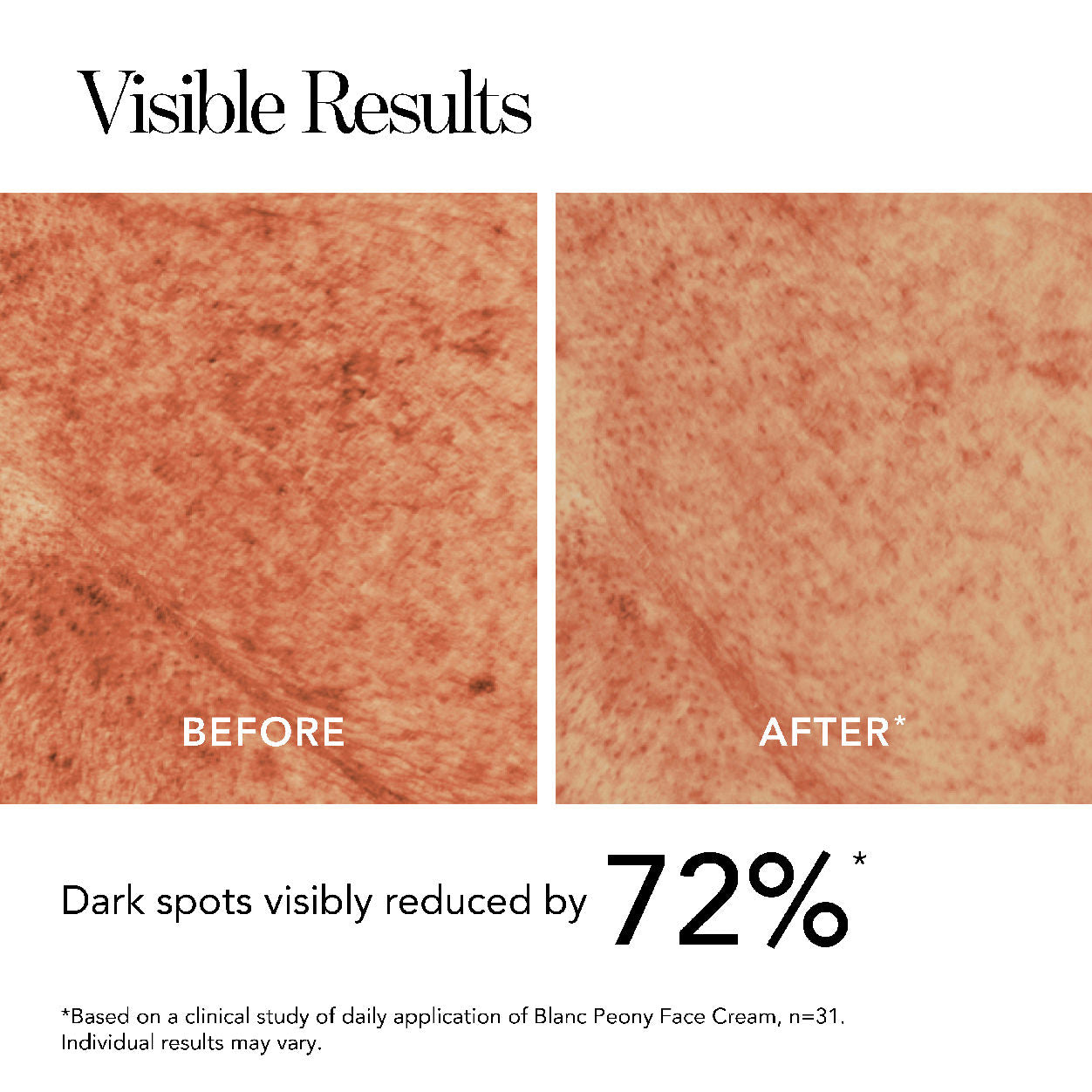 Top-view image of Chantecaille Blanc Peony Face Cream for Dark Spots