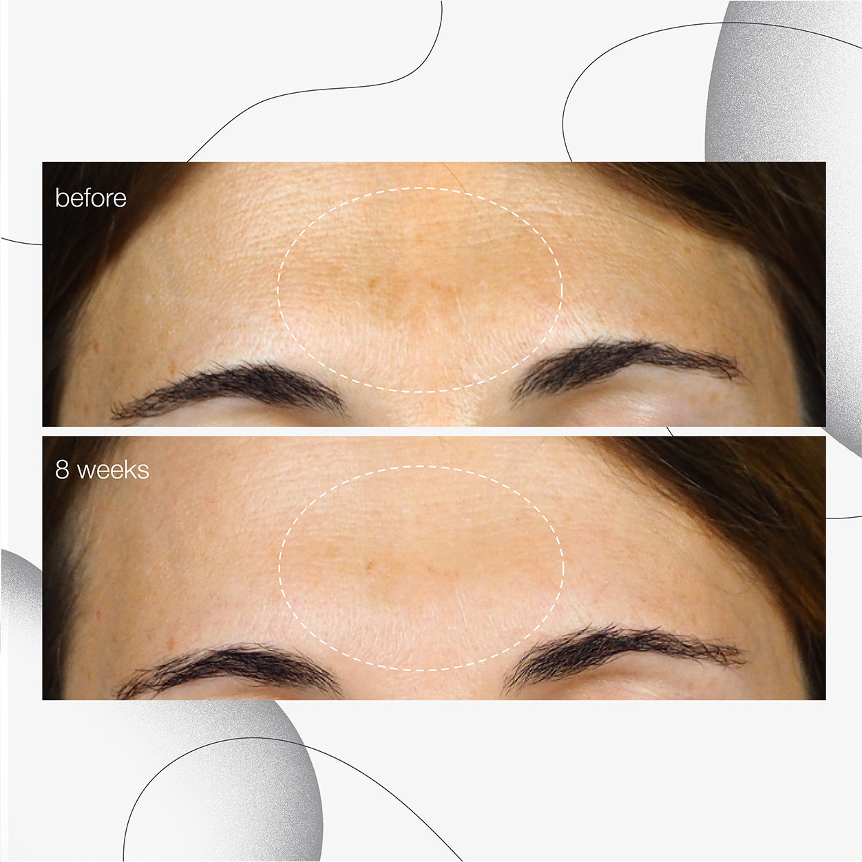 Model image of Dermalogica PowerBright Dark Spot Serum