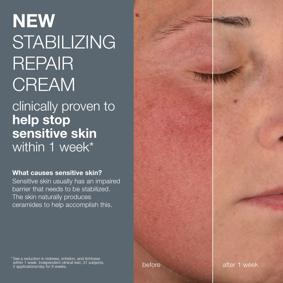 Before and after results of using Dermalogica Stabilizing Repair Cream