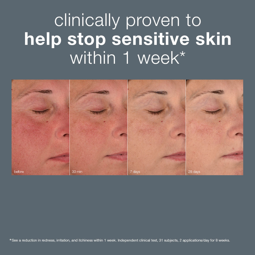 Before and after results of using Dermalogica Stabilizing Repair Cream