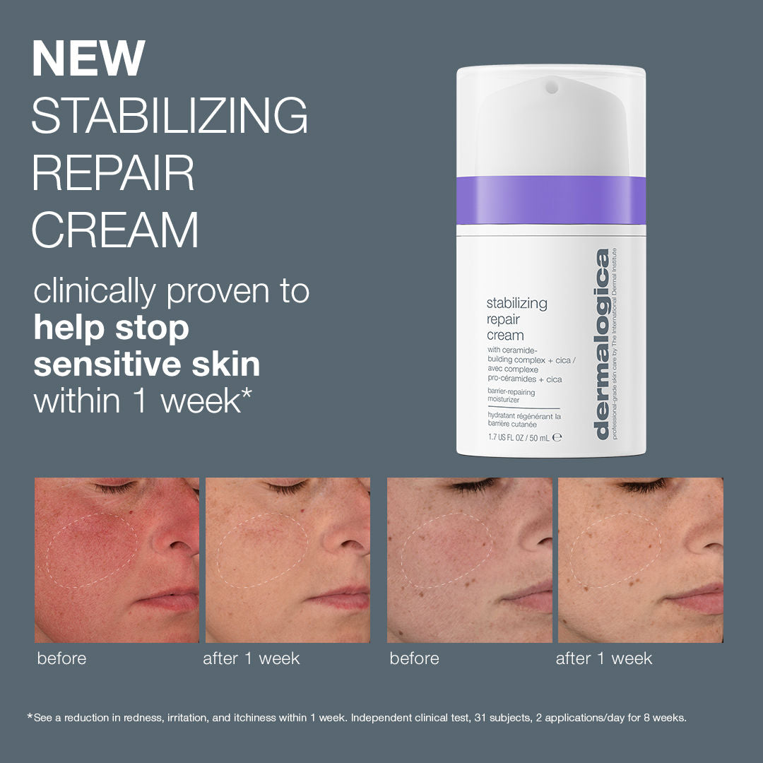 Before and after results of using Dermalogica Stabilizing Repair Cream