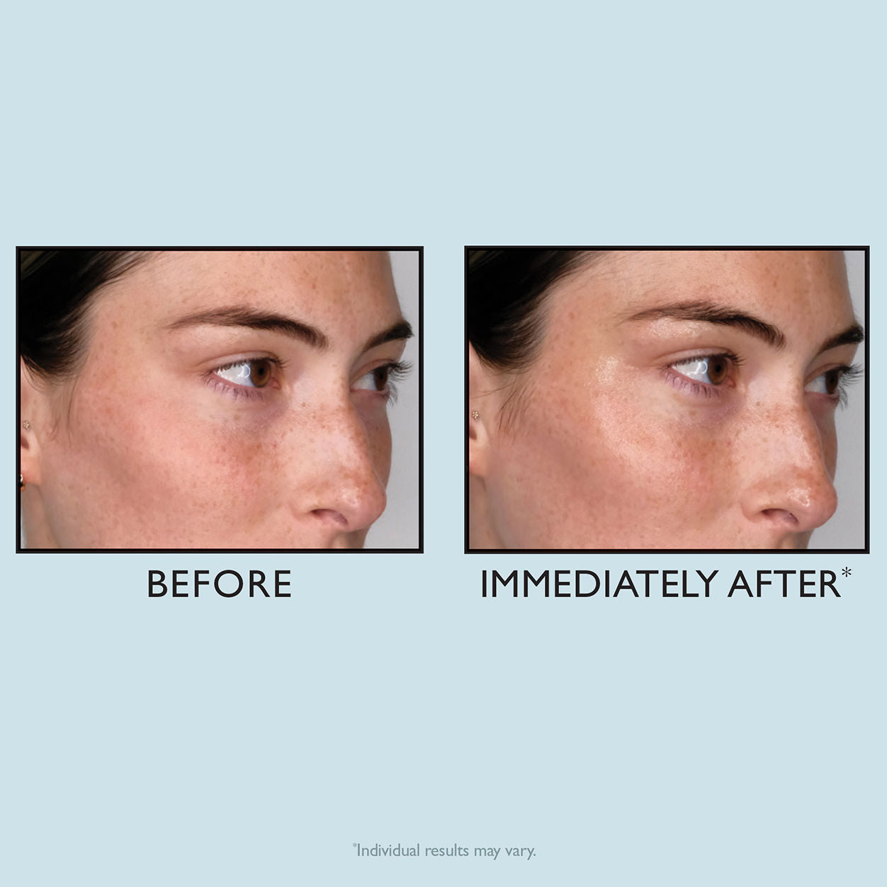 Before and after results of using Peter Thomas Roth Water Drench Hyaluronic Glow Serum
