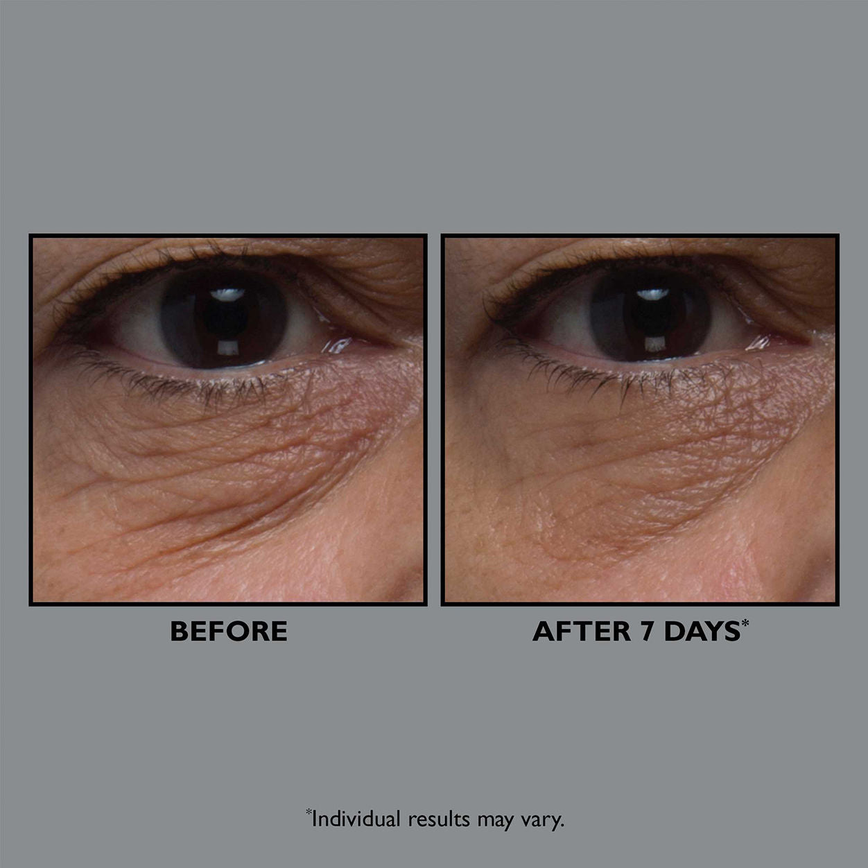 Before and after results of using Peter Thomas Roth FirmX Collagen Eye Cream
