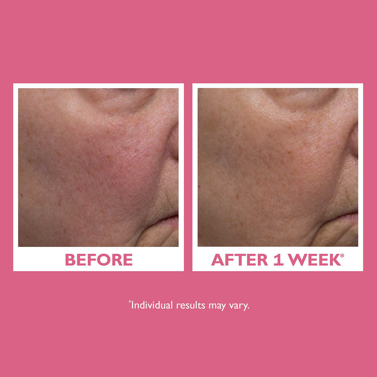 Before and after results of using Peter Thomas Roth Vital-E Microbiome Age Defense Cream