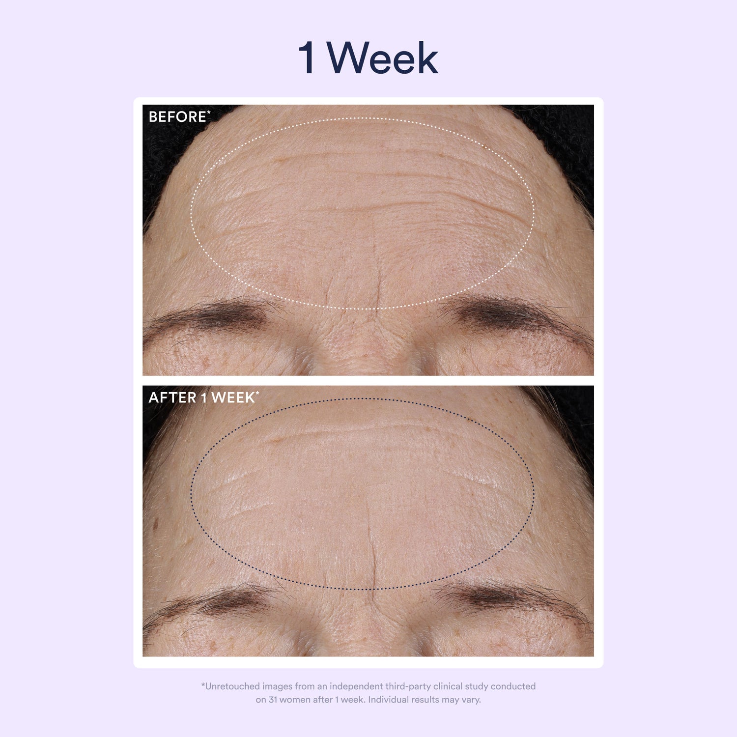 Before and after results of using OSEA Dream Night Serum with Bio-Retinol