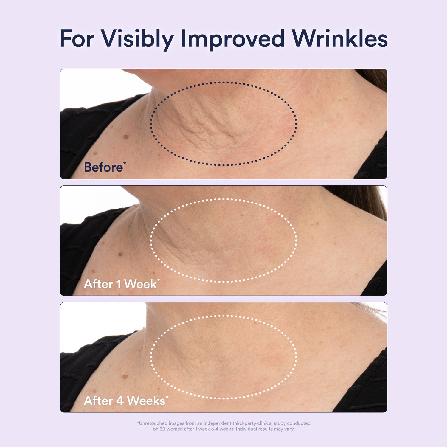 Before and after results of using OSEA Dream Bio-Retinol Body Serum