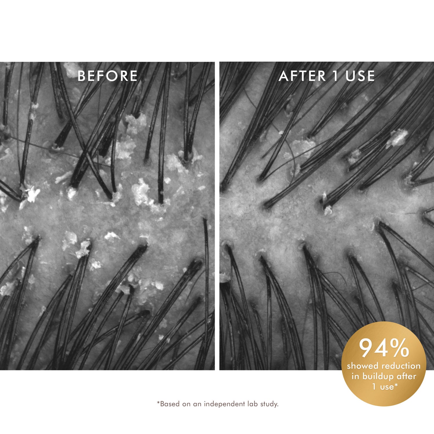 Before and after results of using Moroccanoil Purifying Scalp Scrub