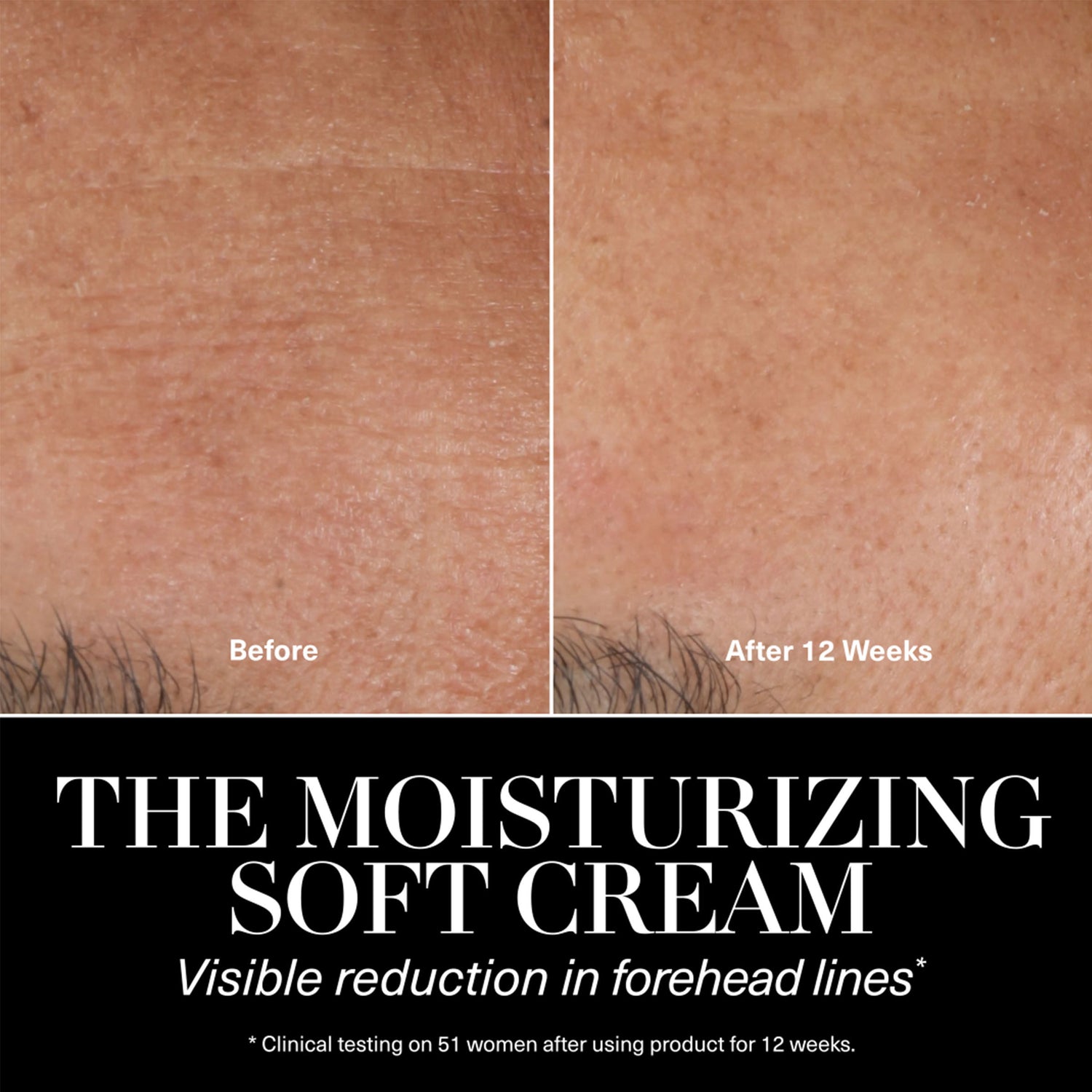 Before and after results of using La Mer The Moisturizing Soft Cream Duet (Limited Edition)
