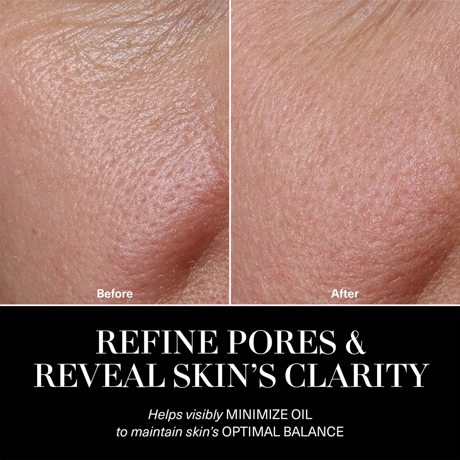 Before and after results of using La Mer The Balancing Treatment Lotion