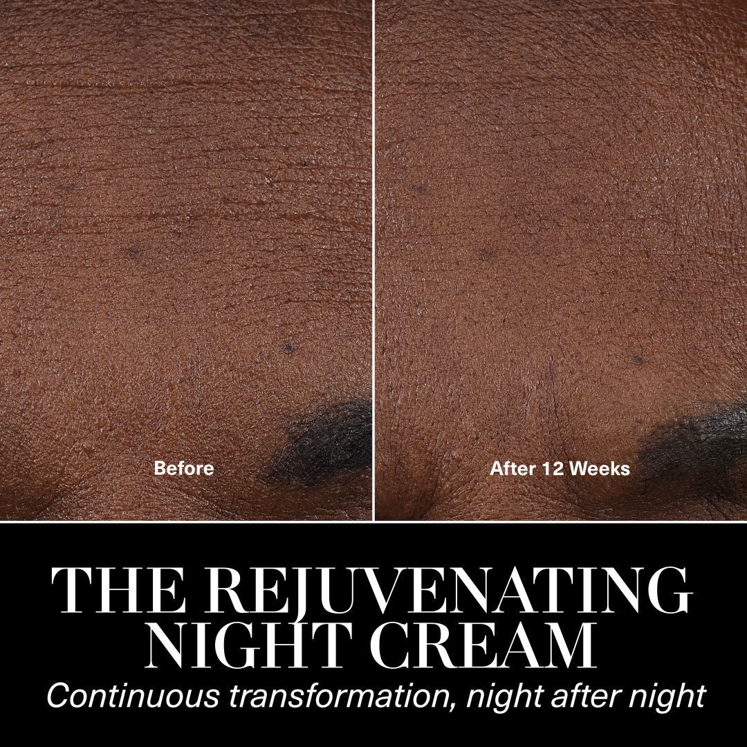 Before and after results of using La Mer The Rejuvenating Night Cream Duet (Limited Edition)