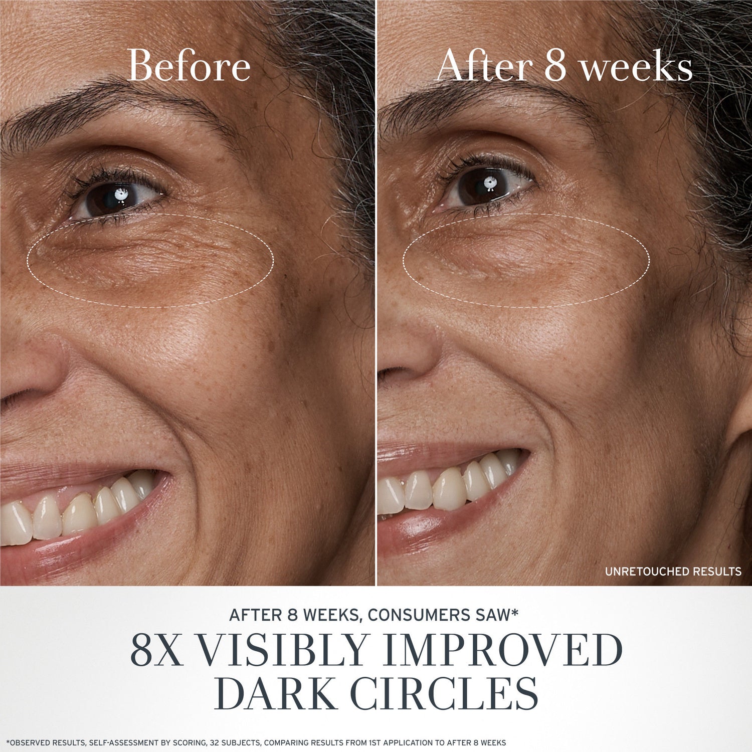 Before and after results of using Fresh Black Tea Anti-Aging Eye Cream