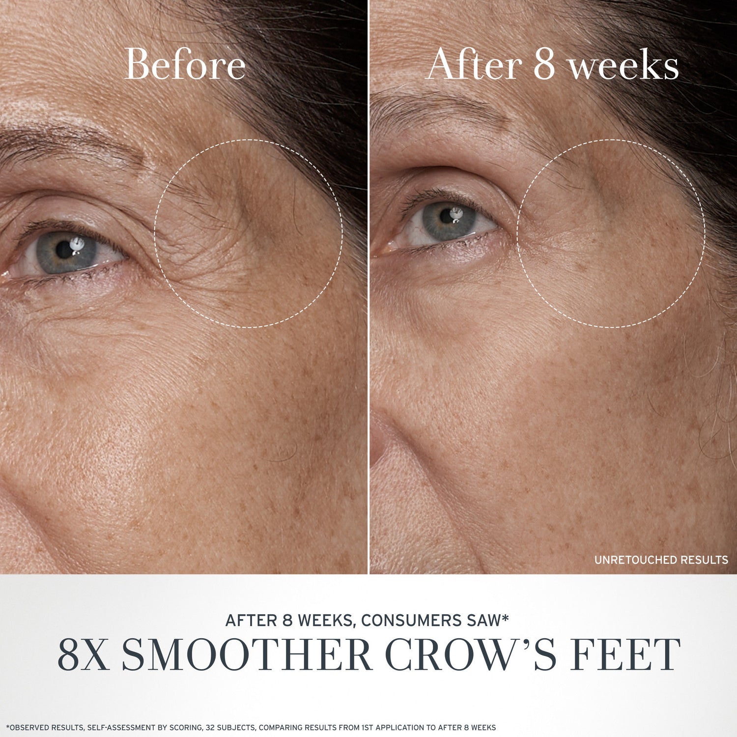 Before and after results of using Fresh Black Tea Anti-Aging Eye Cream