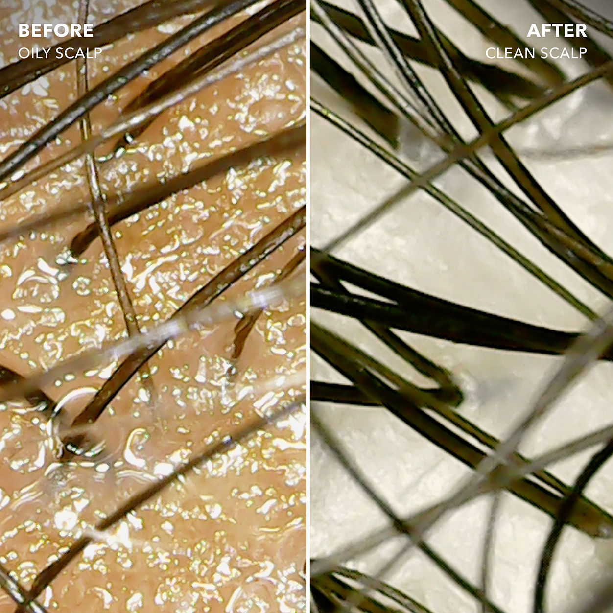 Before and after results of using Sunday II Sunday Root Refresh Micellar Rinse