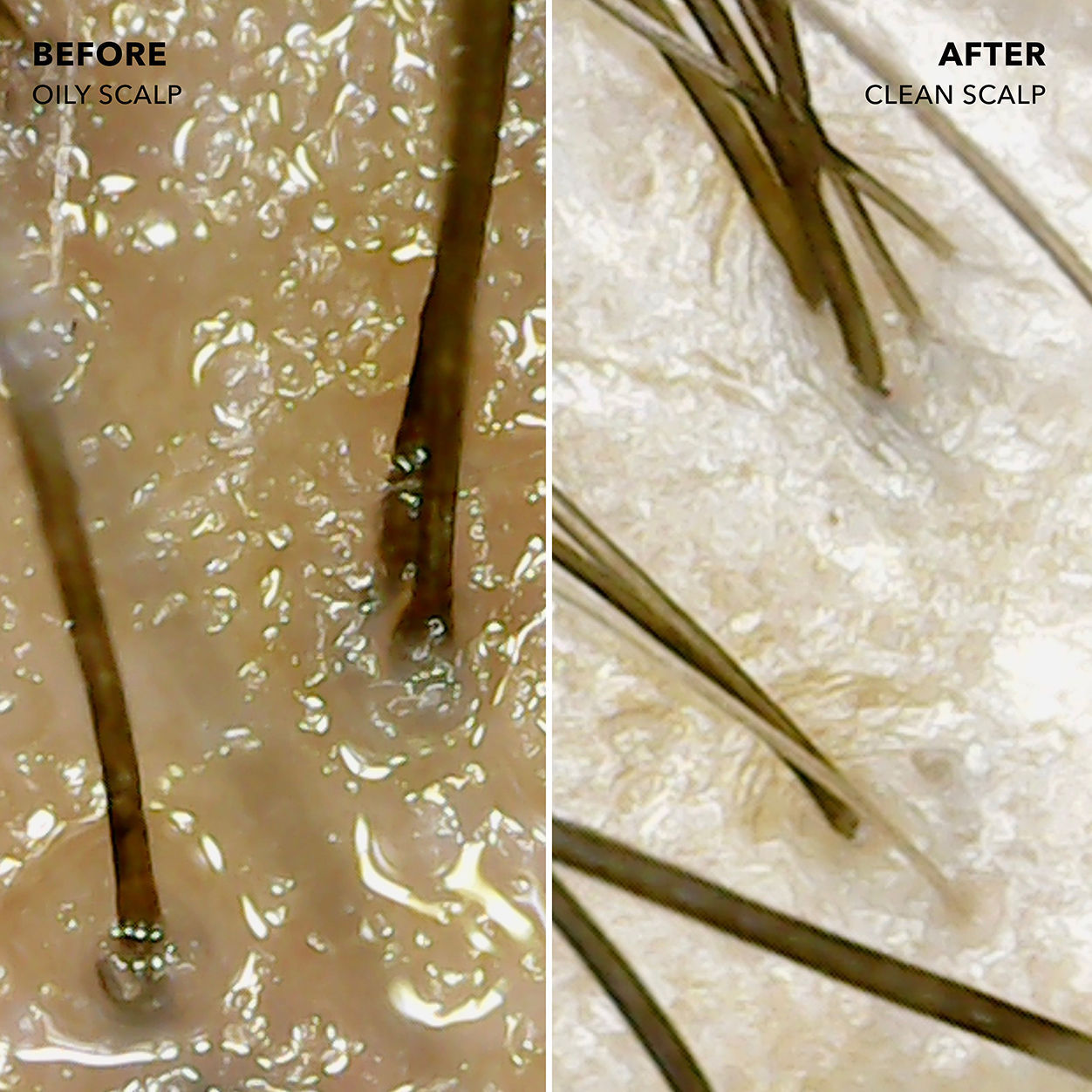 Before and after results of using Sunday II Sunday Root Refresh Micellar Rinse