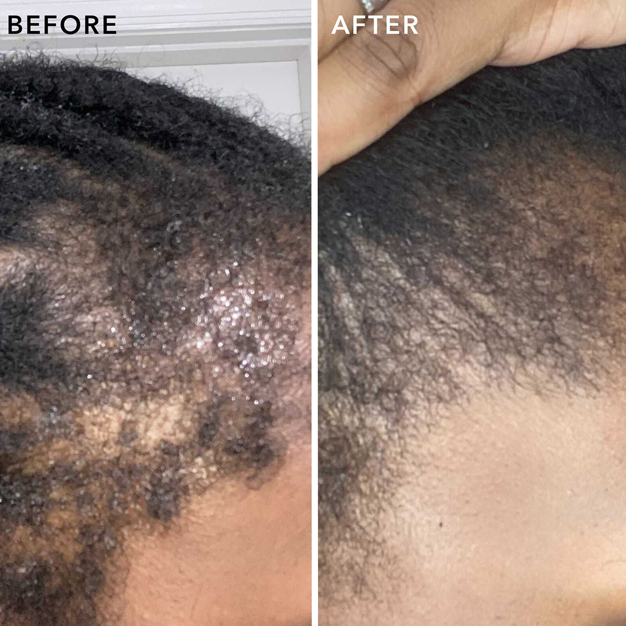 Before and after results of using Sunday II Sunday Edge Flourish Overnight Nourishing Oil-Based Serum