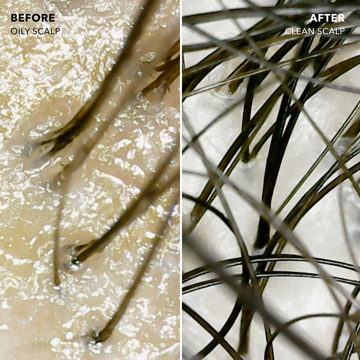 Before and after results of using Sunday II Sunday Signature Scalp Balancing Shampoo