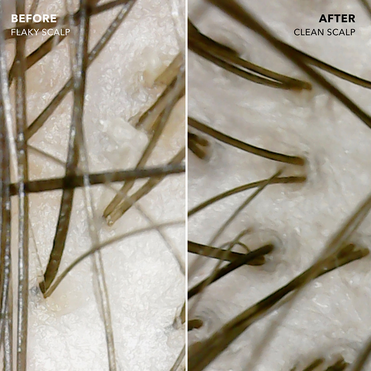 Before and after results of using Sunday II Sunday Signature Scalp Balancing Shampoo