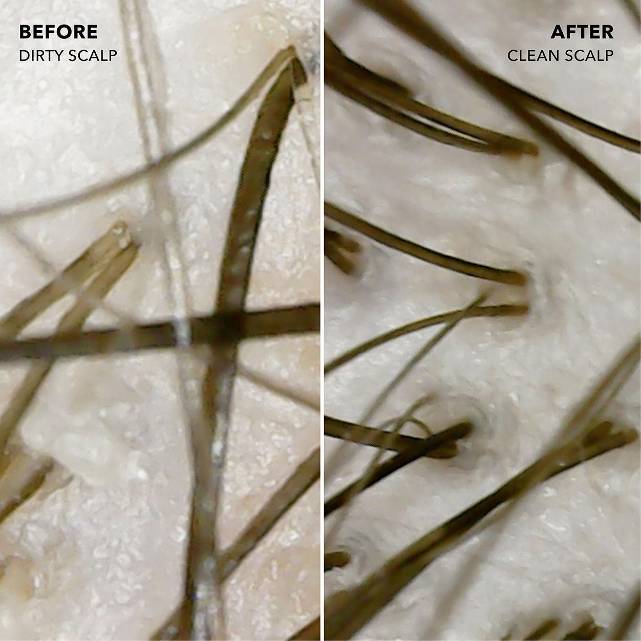 Before and after results of using Sunday II Sunday Detox and Fortify Pre-Shampoo Foam