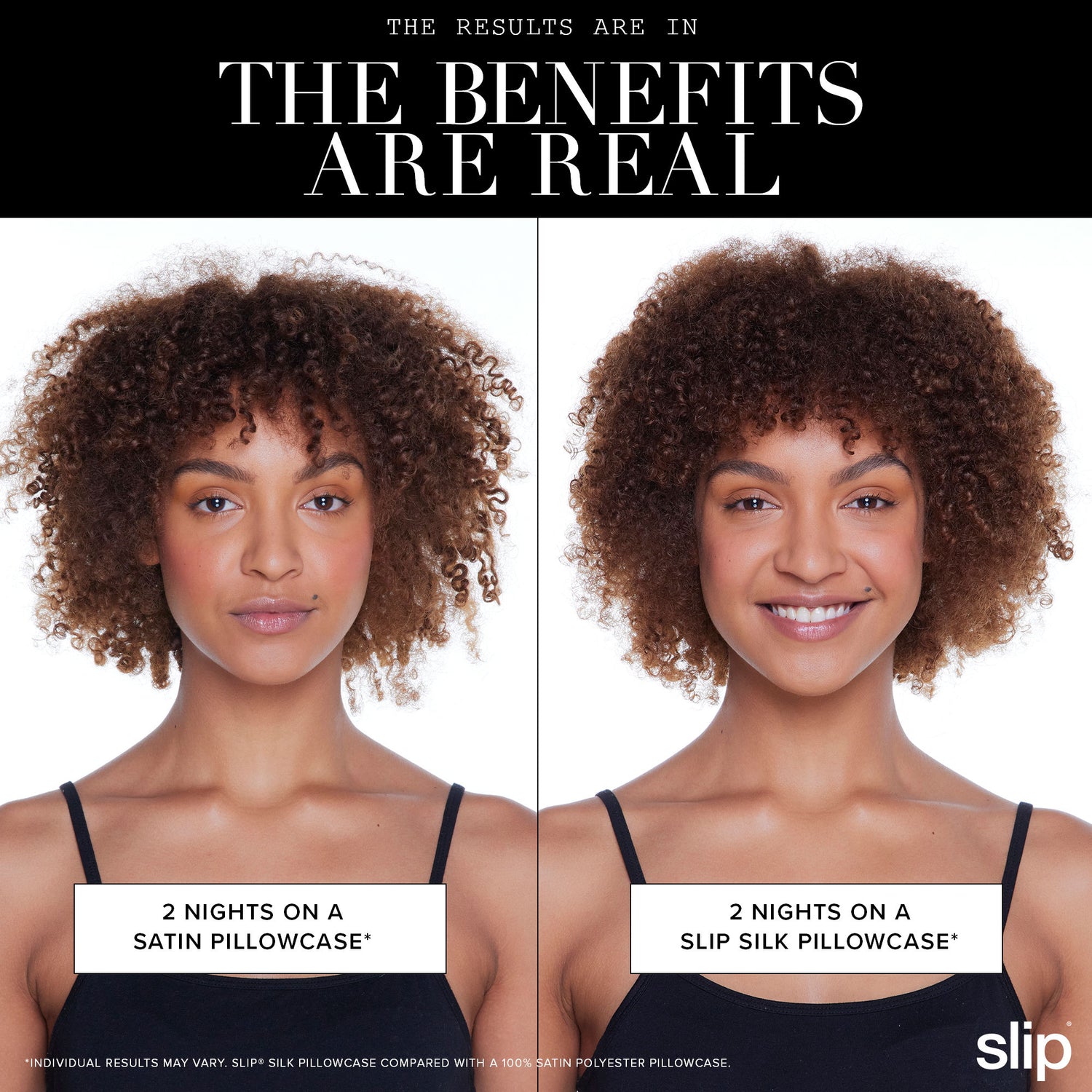 Before and after results of using Slip Pure Silk Queen Gift Set with Lace Trim (Limited Edition)