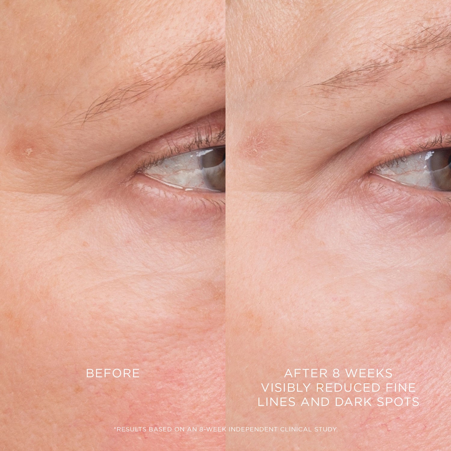Before and after results of using Hourglass Equilibrium Resurfacing Retinoid Treatment