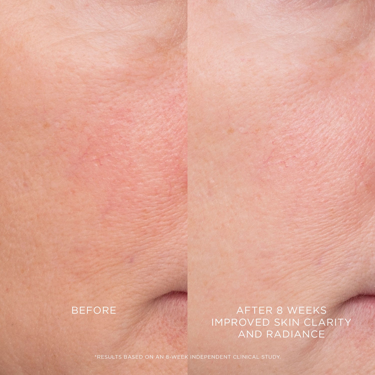 Before and after results of using Hourglass Equilibrium Resurfacing Retinoid Treatment