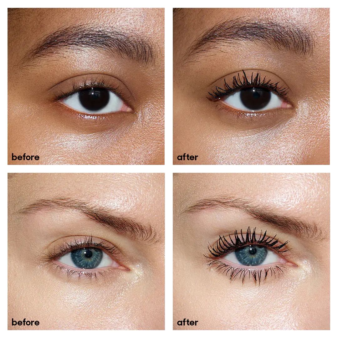 Before and after results of using Neen Ultimate Eye Trio (Limited Edition)