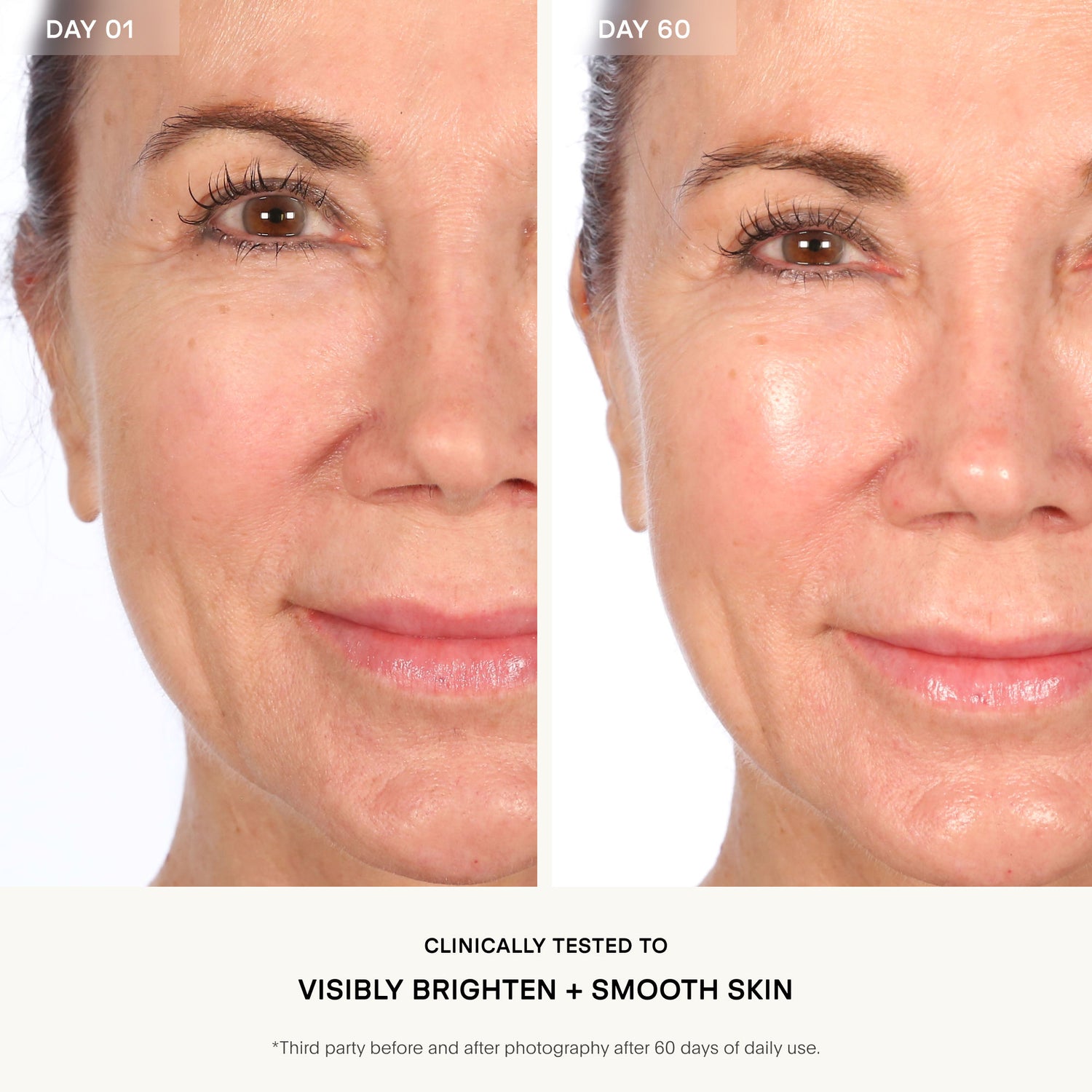 Before and after results of using U Beauty Resurfacing Flash Peel