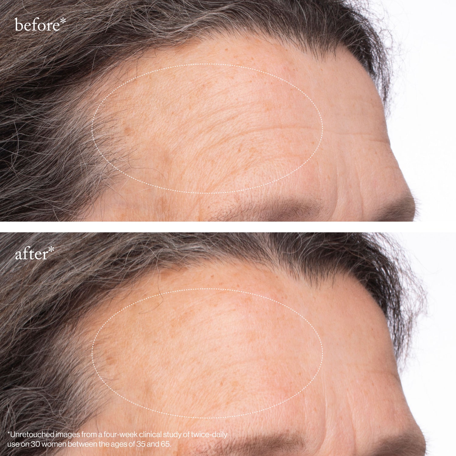 Before and after results of using Goop Beauty Youth-Boost NAD+ Peptide Rich Cream
