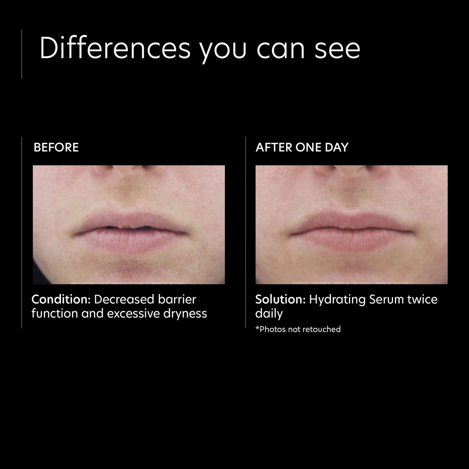 Before and after results of using PCA Skin Hydrating Serum