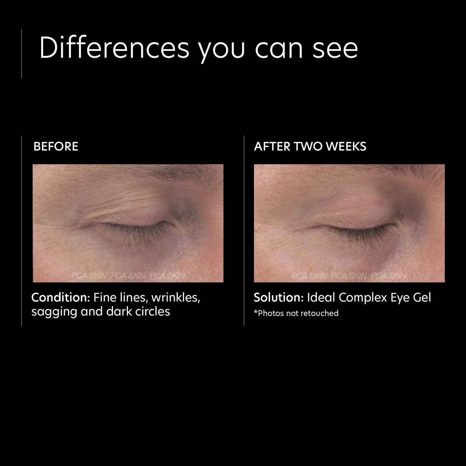 Before and after results of using PCA Skin Ideal Complex Revitalizing Eye Gel