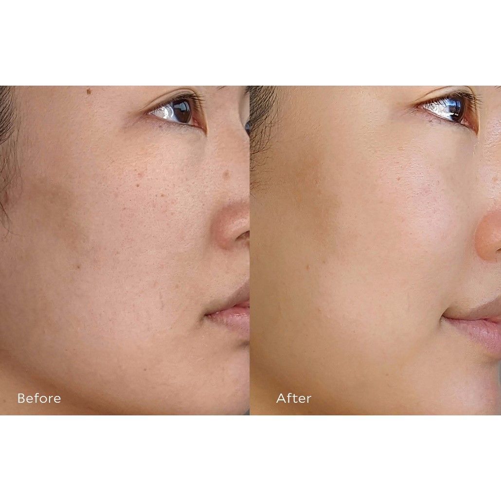 Before and after results of using Tata Harper Resurfacing Serum