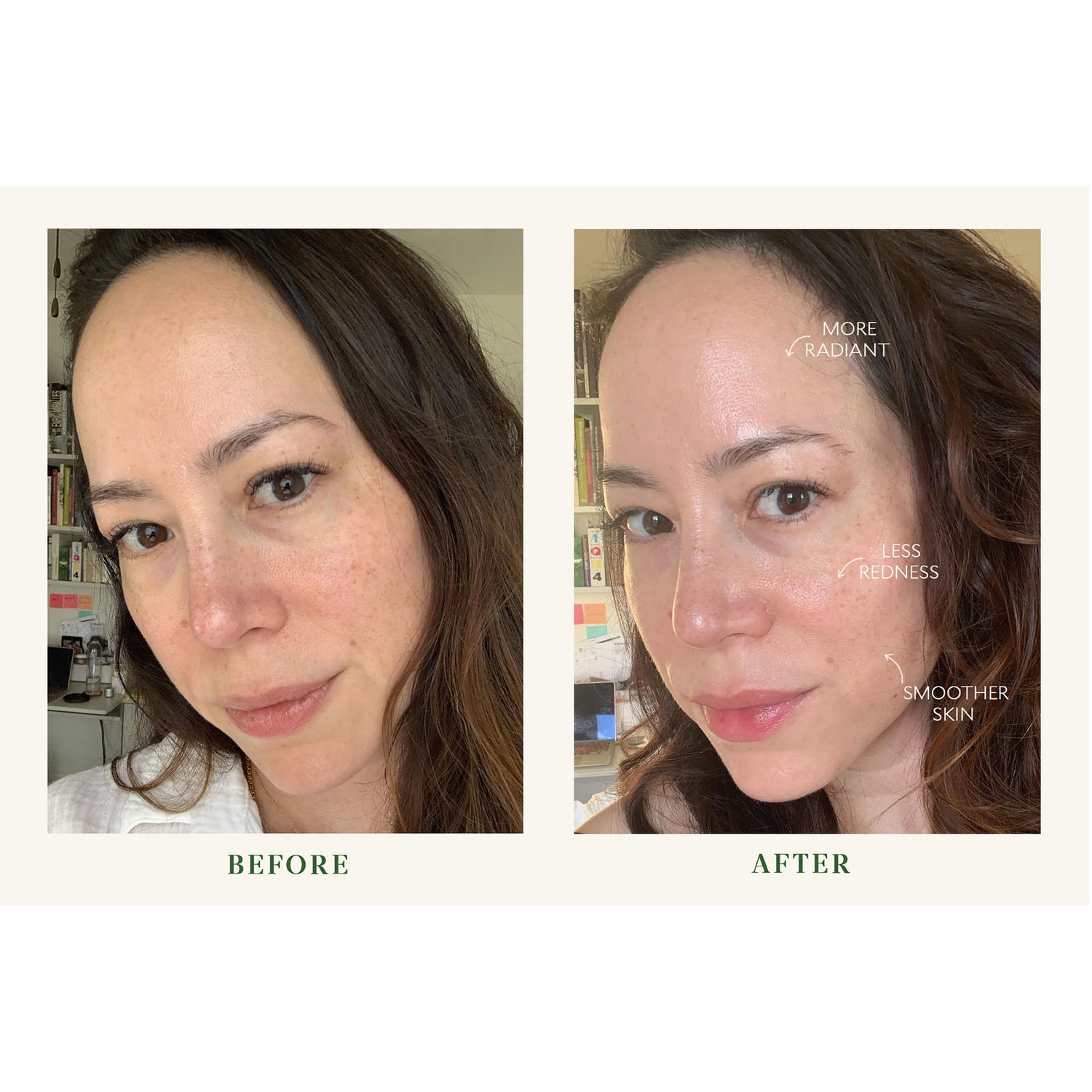 Before and after results of using Tata Harper Superkind Refining Cleanser