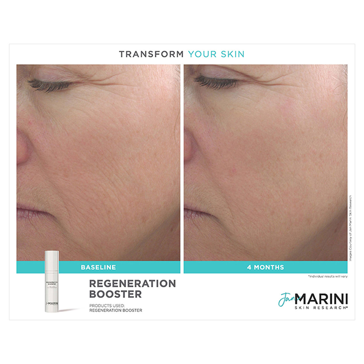 Before and after results of using Jan Marini Age Intervention Regeneration Booster