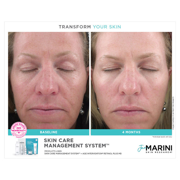 Jan Marini Skin Care Management System Normal or Combination