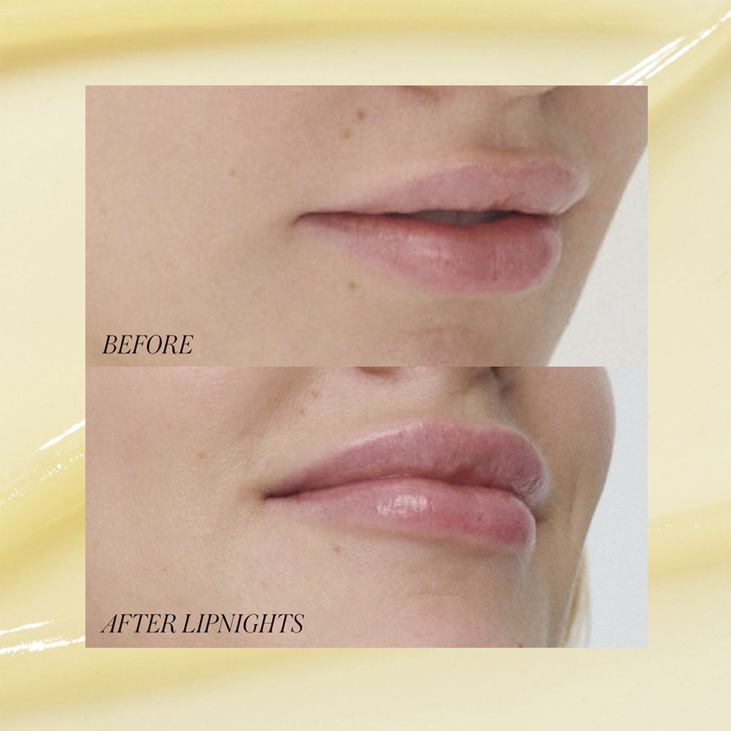 Before and after results of using RMS Beauty Lipnights Overnight Lip Mask