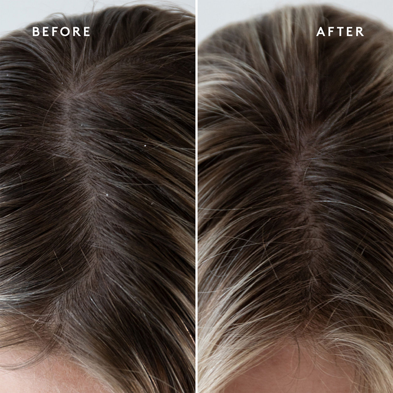 Before and after results of using Virtue Refresh Exfoliating Scalp Treatment