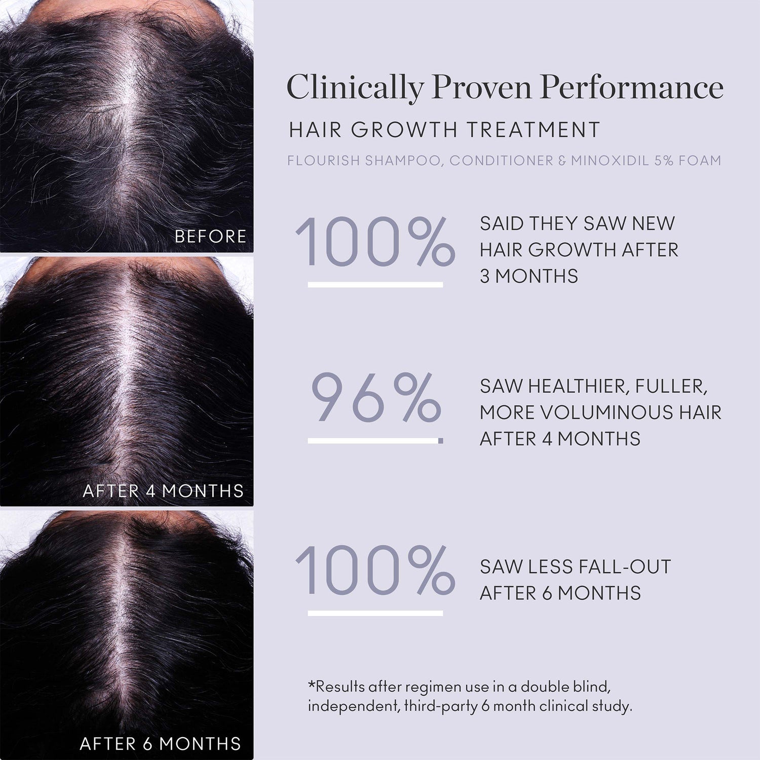 Before and after results of using Virtue Flourish Nightly Intensive Hair Growth Treatment 90 Day