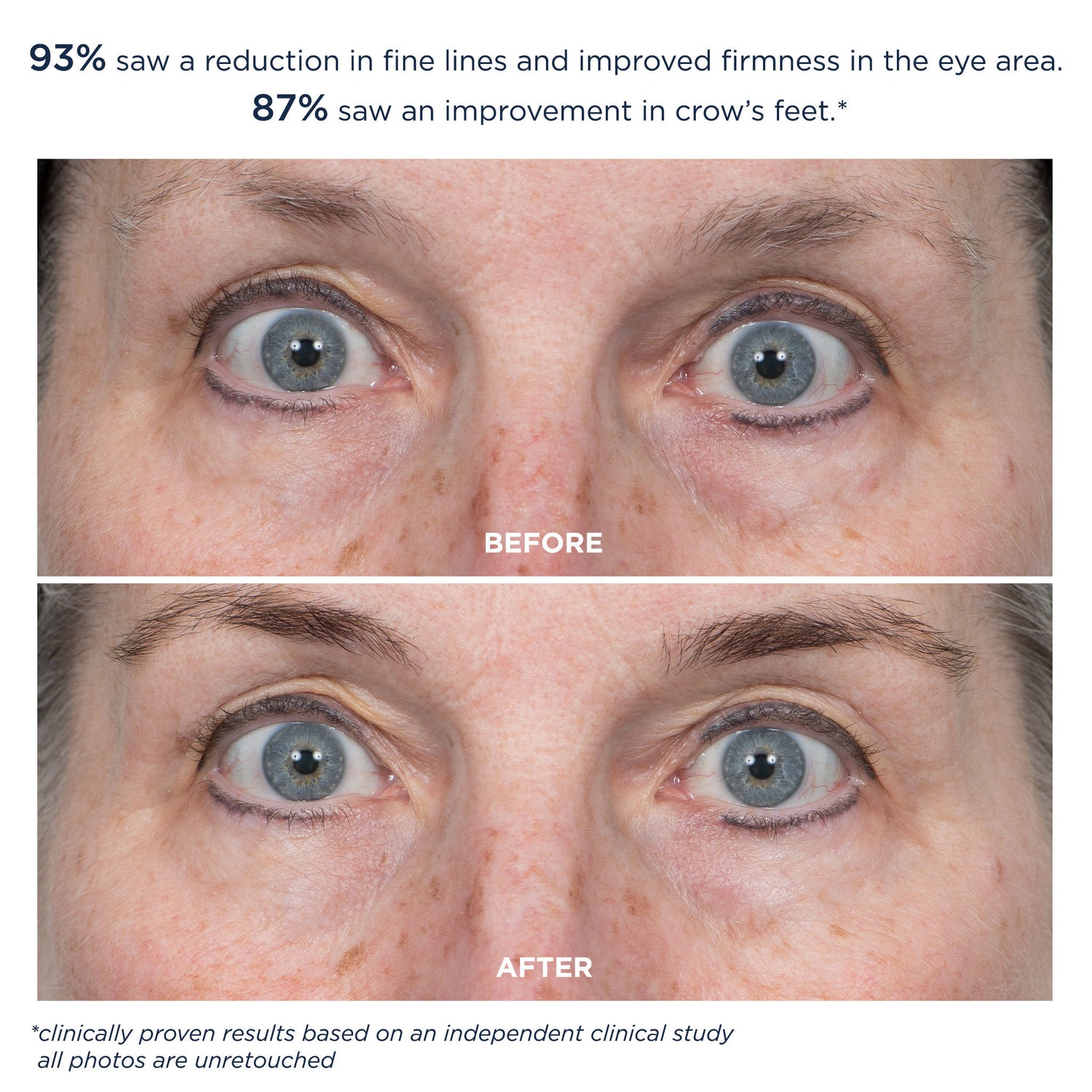 Before and after results of using M-61 ProSmooth Retinol Eye Serum