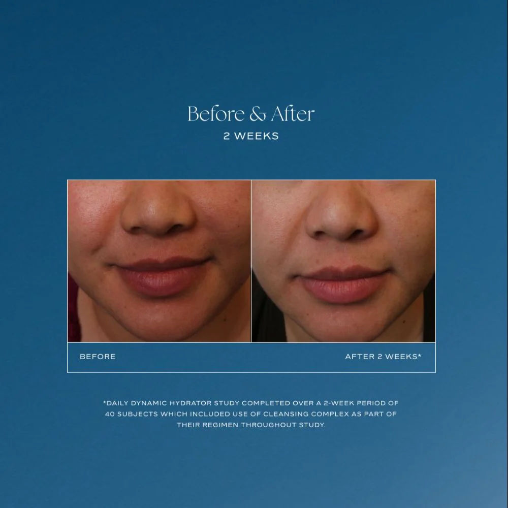 Before and after results of using IS Clinical Daily Dynamic Hydrator
